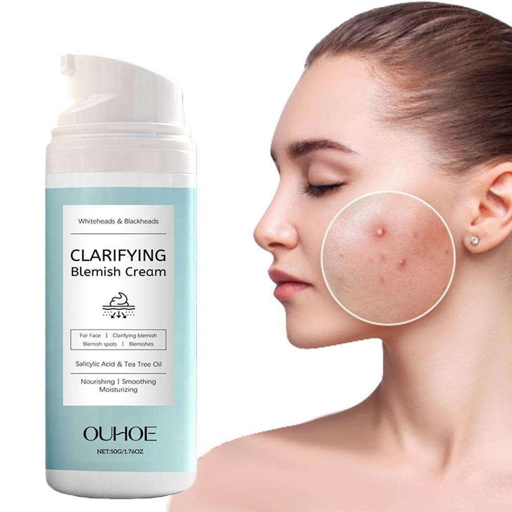 Azelaic Acid Cream - Крем для лица с салициловой кислотой