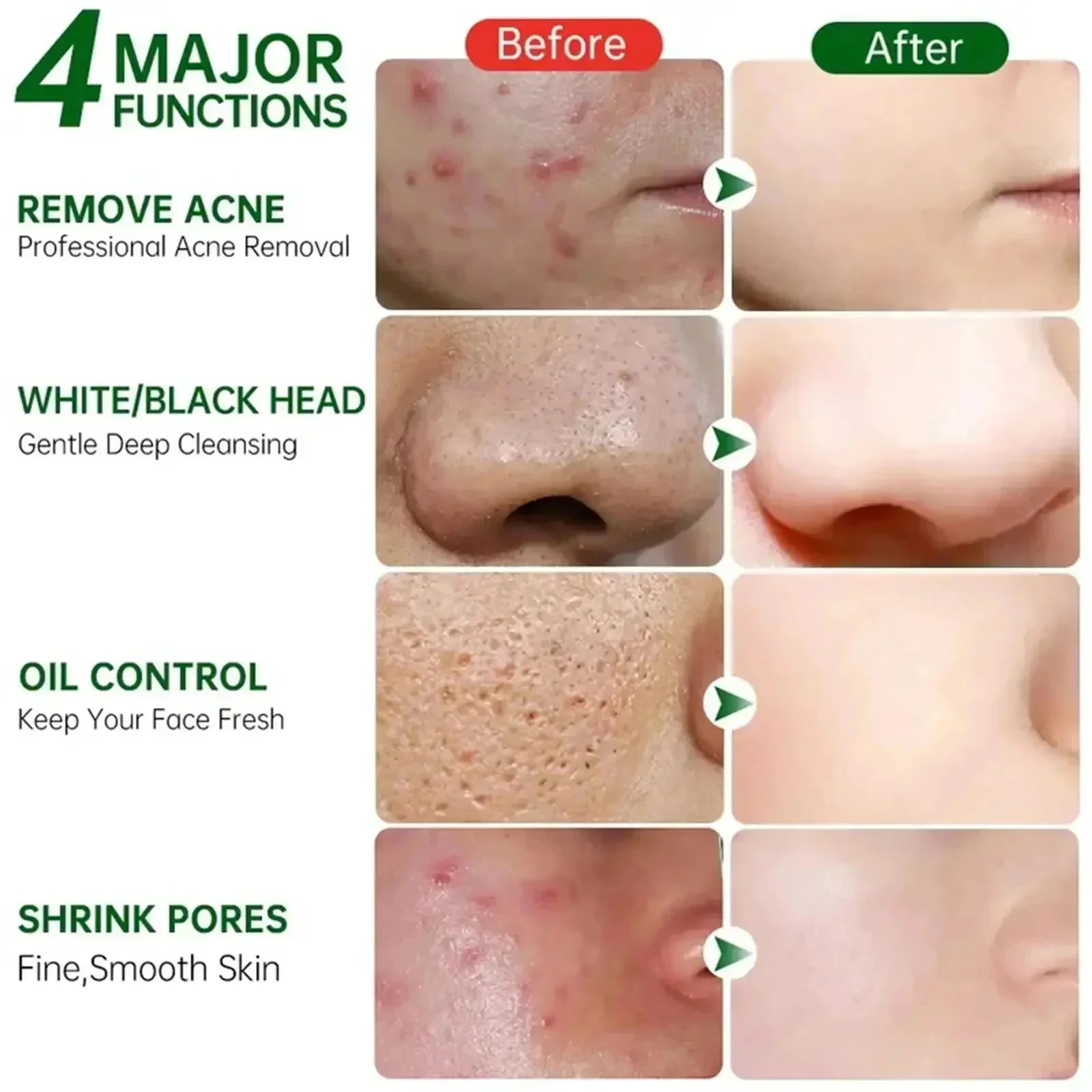 Крем для очищения пор с салици – обзор и цена Azelaic Acid Cream