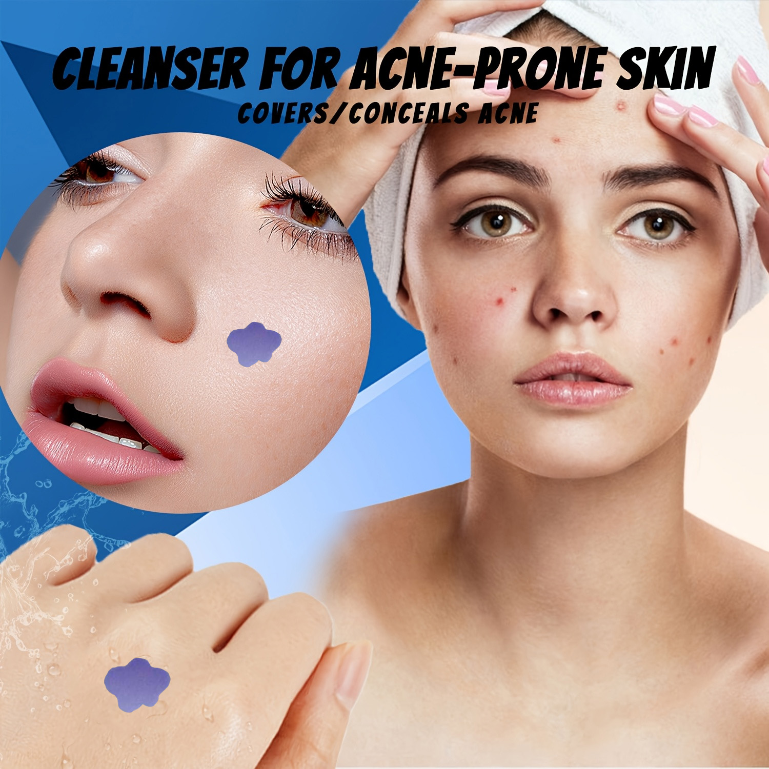 Микронидл-пластыри от акне и п – обзор и цена Skincare You