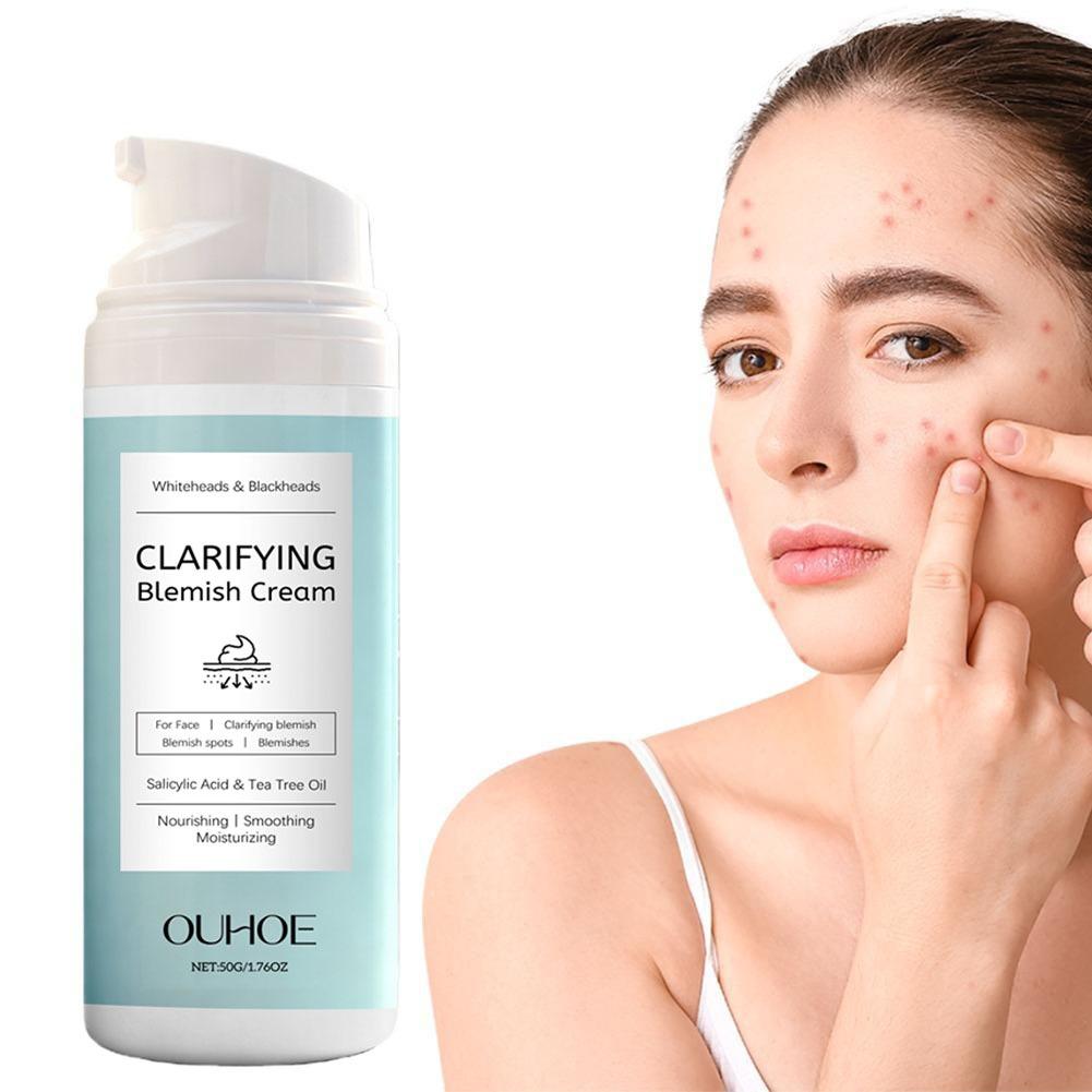 Крем для лица с салициловой ки – обзор и цена Azelaic Acid Cream