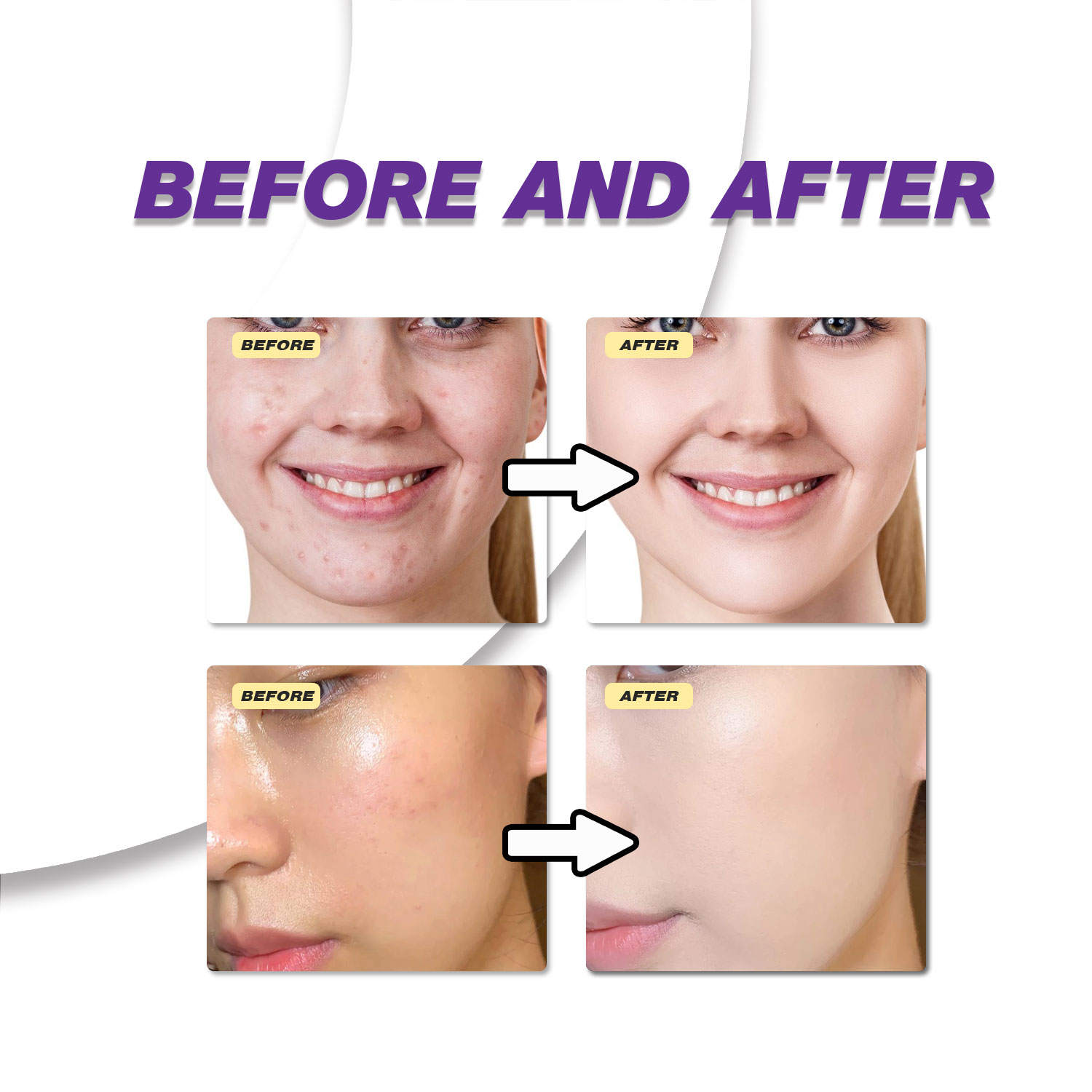 Мягкий крем с азелаиновой кисл – обзор и цена Azelaic Acid Cream