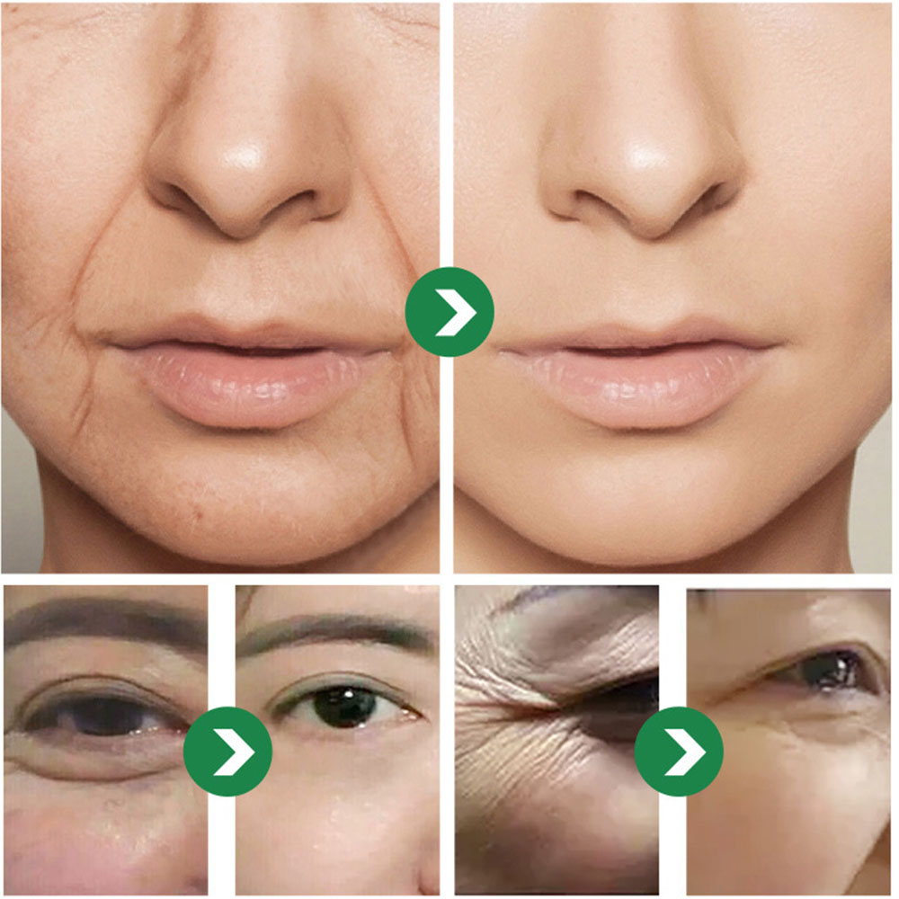 Японский крем с шестью пептида – обзор и цена Eye Cream Peptide